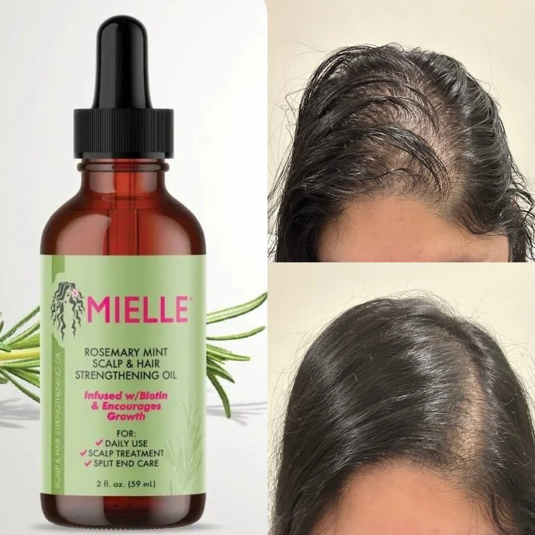 Mielle Scalp Rosemary Oil